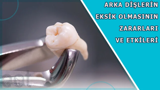 Arka-Dislerin-Eksik