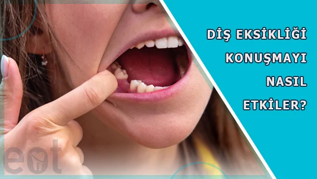 Dis-Eksikligi-Konusmayi