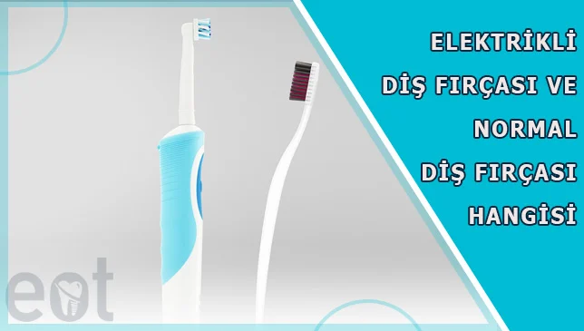 elektirikli-dis-fircasi
