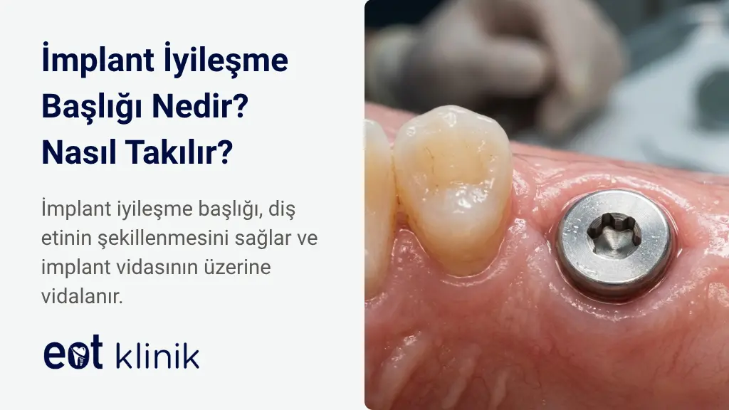 İmplant İyileşme Başlığı (Gingiva Former) | EOT Klinik Ankara