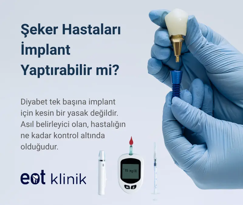 Şeker Hastaları İmplant Yaptırabilir mi? Tip 2 Diyabet İmplant İçin Engel mi?