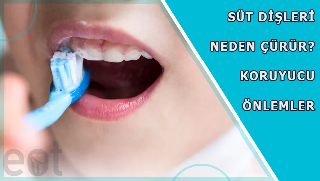 Sut-Disleri-Neden-curur