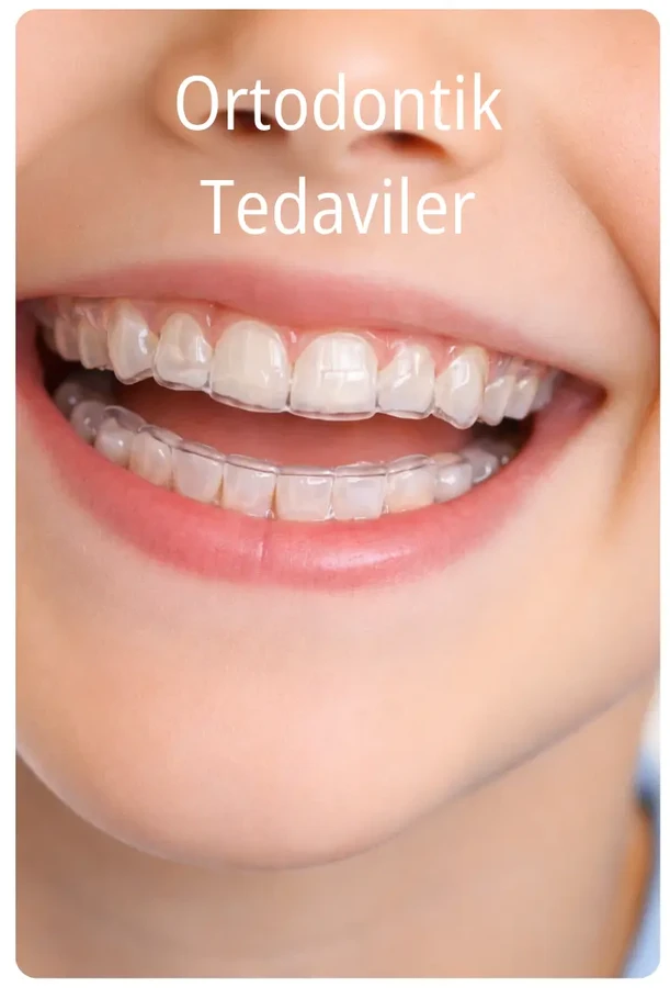 Orthodontic Treatment Before & After