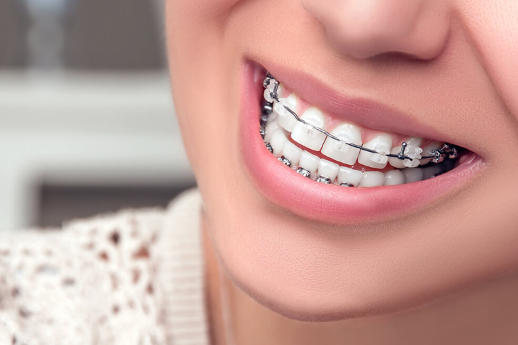 ortodonti Uzmanı Ankara