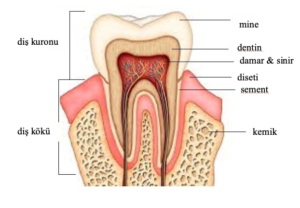 aniden oluşan diş hassasiyeti