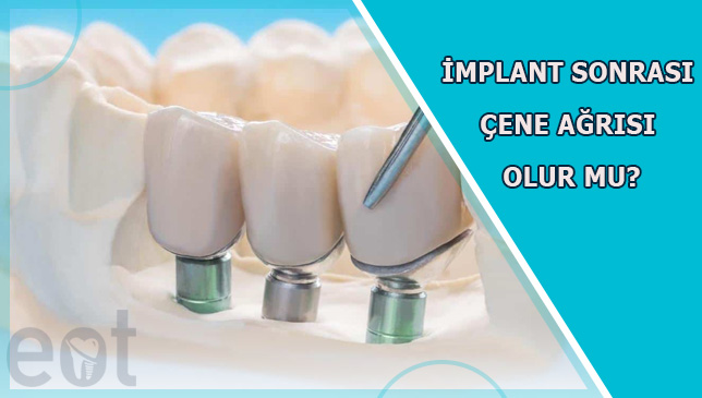 implant-sonrasi-cene-agrisi (2)