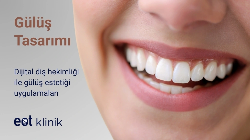 Gülüş Tasarımı Ankara, Gülüş Estetiği