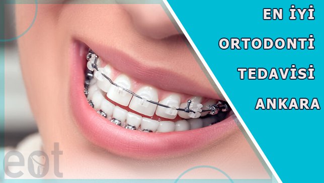 En iyi ortodonti tedavisi ankara