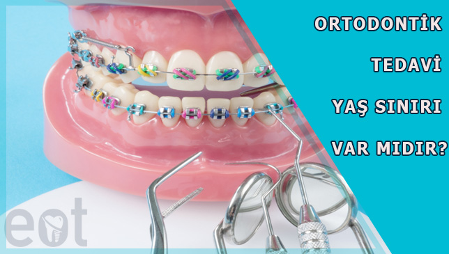 Ortodontik Tedavi Yaş sınırı Var mıdır?
