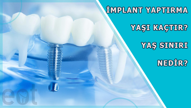 implant-yas-siniri-kaçtir