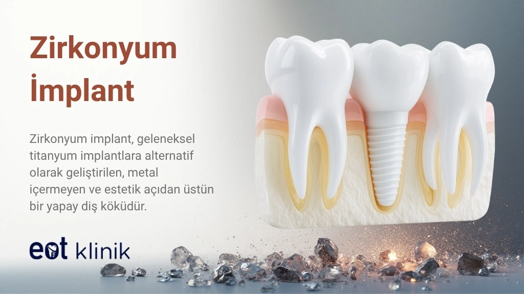 Zirkonyum İmplant Ankara, Zirkonyum İmplant Fiyatları