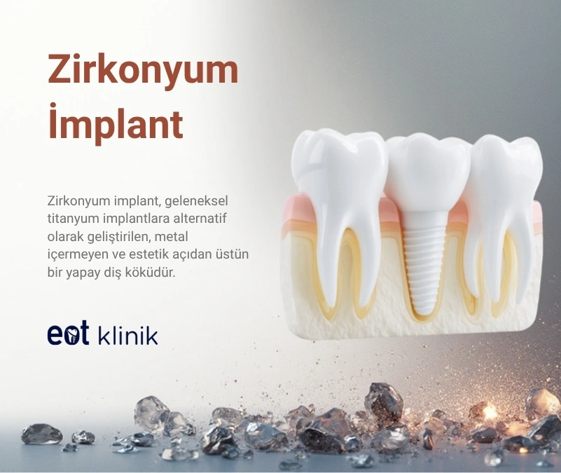 Zirkonyum İmplant Ankara