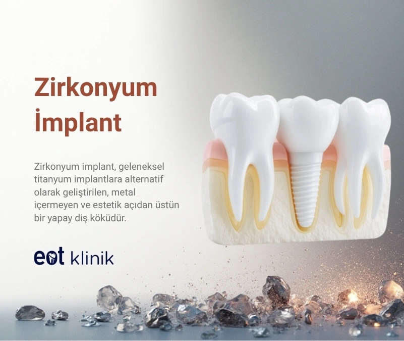 Zirkonyum İmplant Ankara