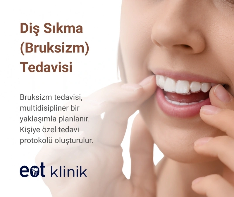 Diş Sıkma (Bruksizm) Tedavisi Fiyatları Ankara