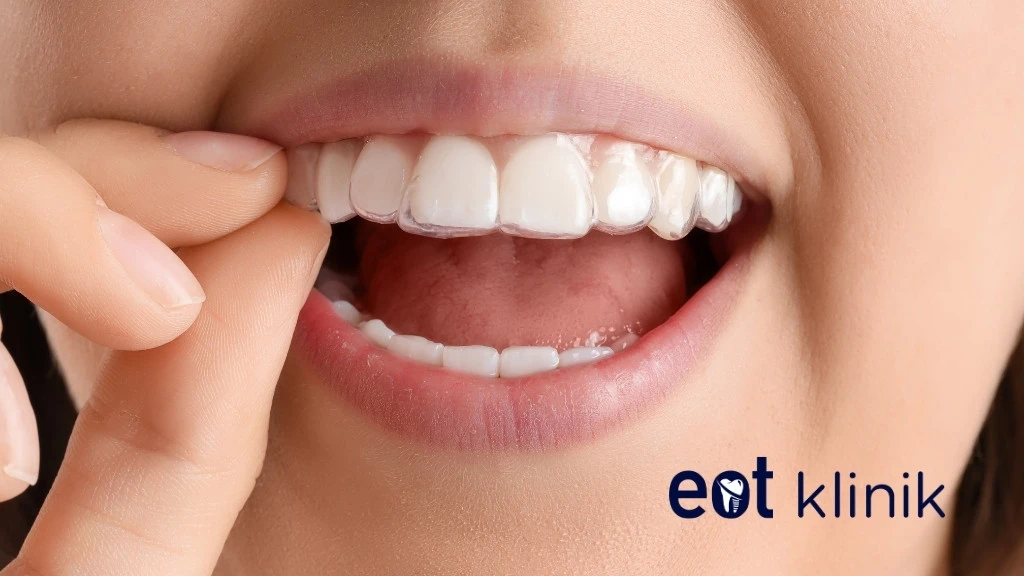 Diş Sıkma Tedavisi Ankara