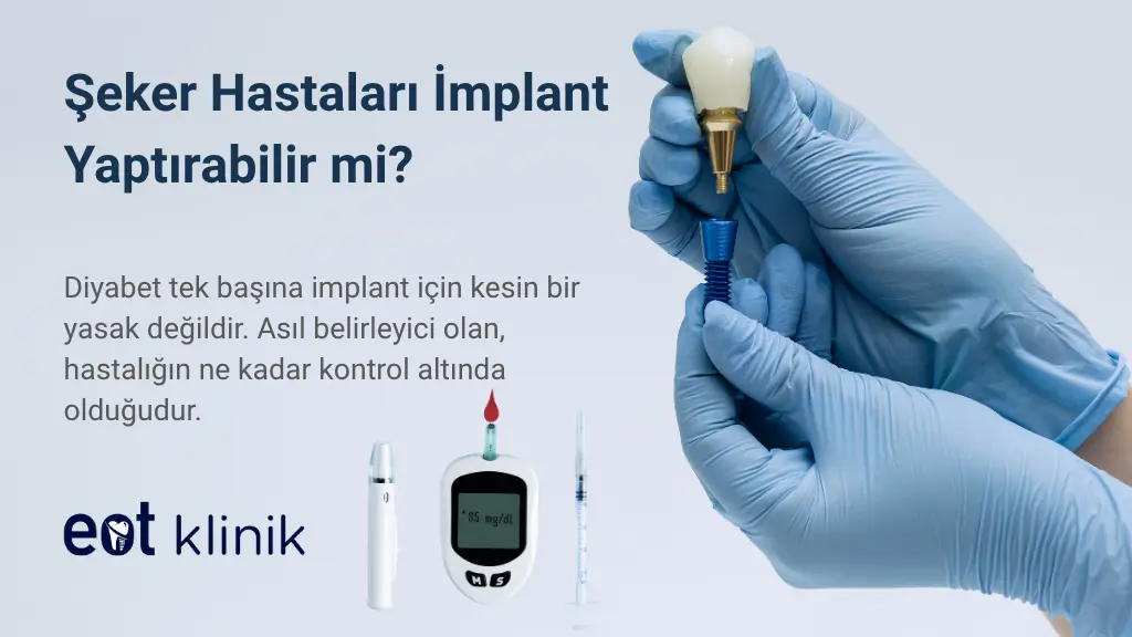 Şeker Hastaları İmplant Yaptırabilir mi? Tip 2 Diyabet İmplant İçin Engel mi?